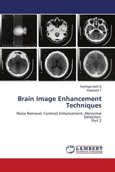Produktbild: Brain Image Enhancement Techniques