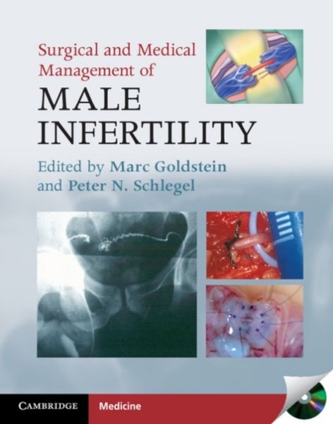 Produktbild: Surgical and Medical Management of Male Infertility
