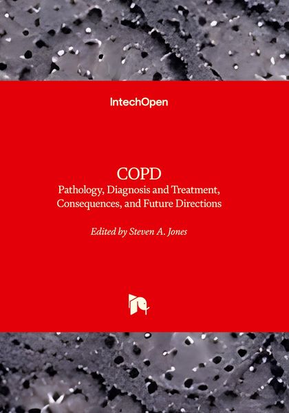 Produktbild: COPD - Pathology, Diagnosis, Treatment, and Future Directions