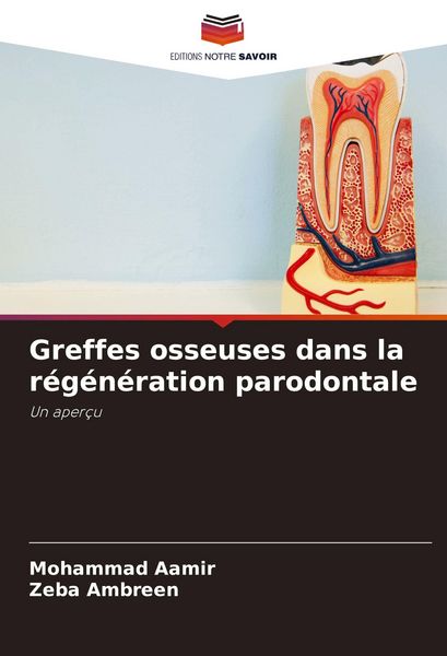 Produktbild: Greffes osseuses dans la r&eacute;g&eacute;n&eacute;ration parodontale