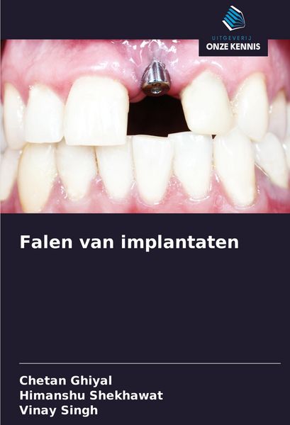 Produktbild: Falen van implantaten