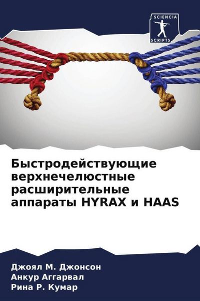 Produktbild: Bystrodejstwu&uuml;schie werhnechel&uuml;stnye rasshiritel'nye apparaty HYRAX i HAAS