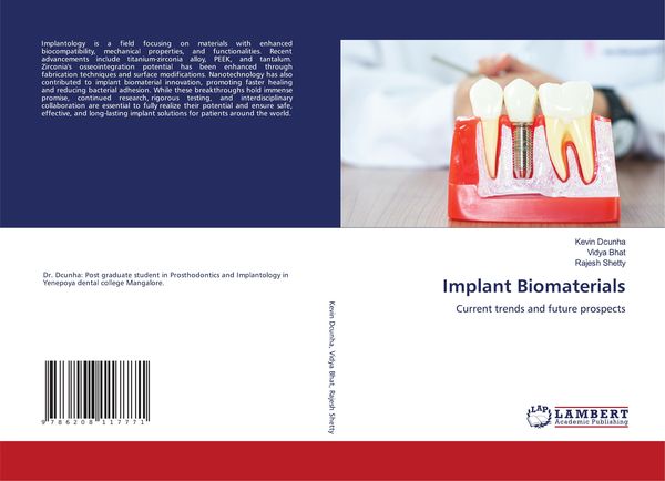 Produktbild: Implant Biomaterials