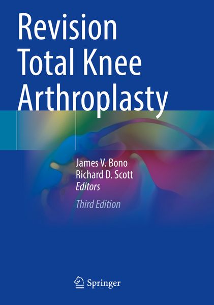 Produktbild: Revision Total Knee Arthroplasty