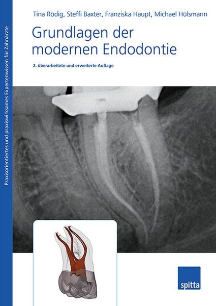 Produktbild: Grundlagen der modernen Endodontie