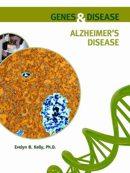 Produktbild: Kelly, E: Alzheimer's Disease