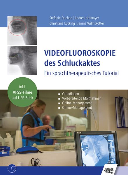 Produktbild: Videofluoroskopie des Schluckaktes
