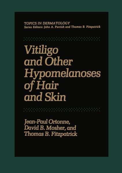 Produktbild: Vitiligo and Other Hypomelanoses of Hair and Skin