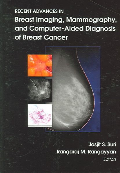 Produktbild: Recent Advances in Breast Imaging, Mammography, And Computer Aided