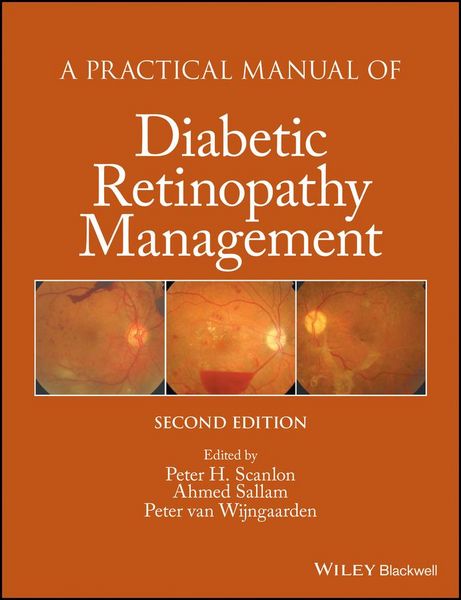 Produktbild: A Practical Manual of Diabetic Retinopathy Management
