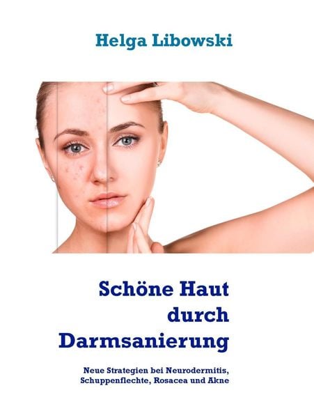 Produktbild: Sch&ouml;ne Haut durch Darmsanierung
