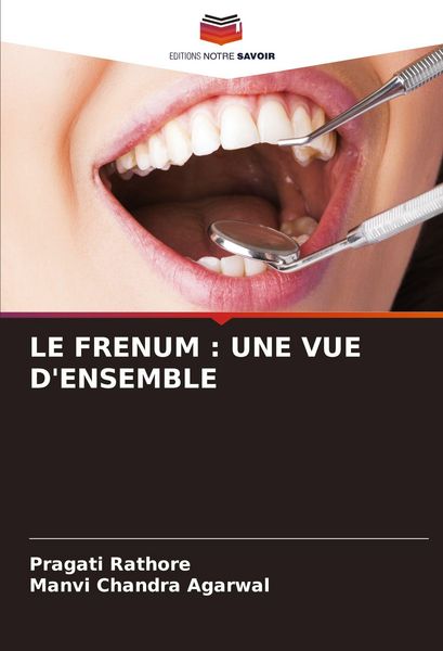 Produktbild: Le Frenum : Une Vue D'ensemble