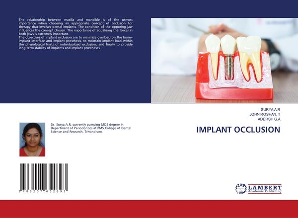 Produktbild: Implant Occlusion
