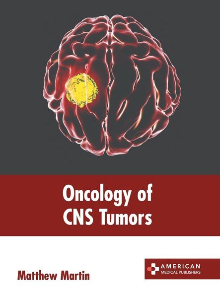 Produktbild: Oncology of CNS Tumors