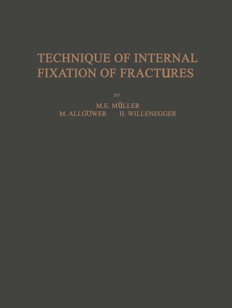 Produktbild: Technique of Internal Fixation of Fractures