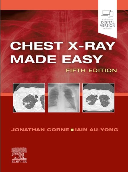 Produktbild: Chest X-Ray Made Easy E-Book