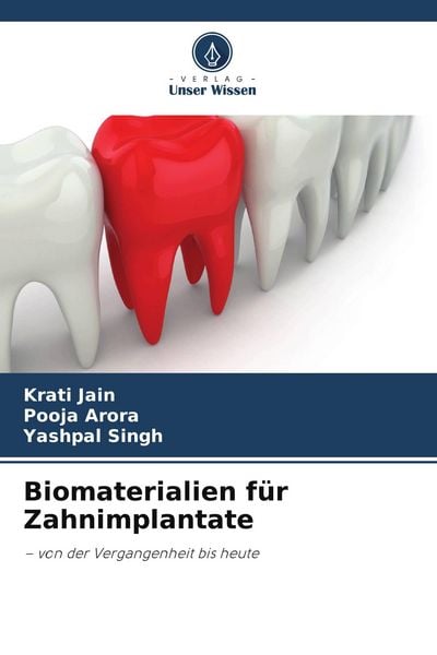 Produktbild: Biomaterialien f&uuml;r Zahnimplantate