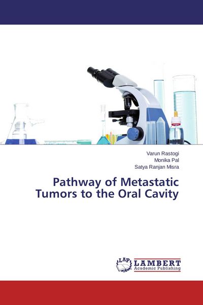 Produktbild: Pathway of Metastatic Tumors to the Oral Cavity