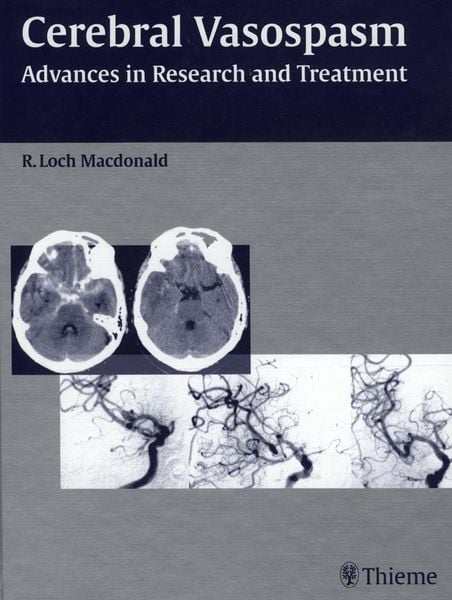 Produktbild: Cerebral Vasospasm