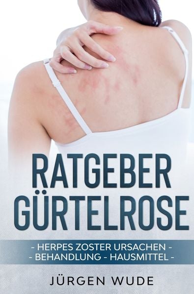 Produktbild: Ratgeber G&uuml;rtelrose