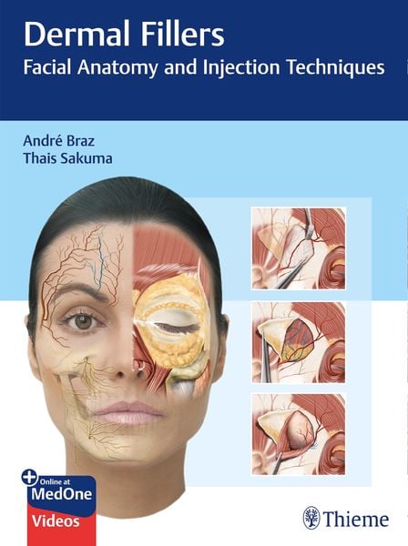 Dermal Fillers, Set von André Vieira Braz,Thais Harumi Sakuma, Thieme, 978-3-13-242772-3