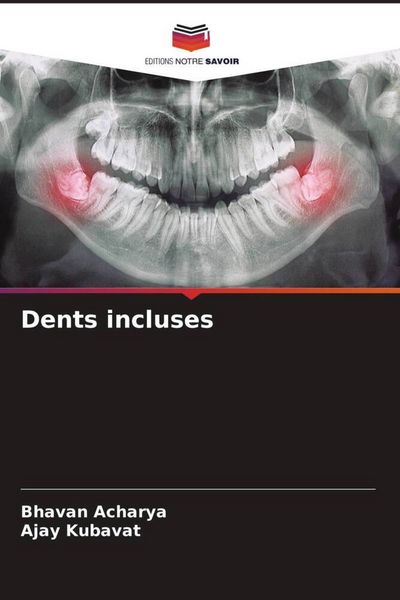 Produktbild: Dents incluses