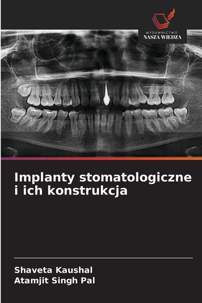 Produktbild: Implanty stomatologiczne i ich konstrukcja