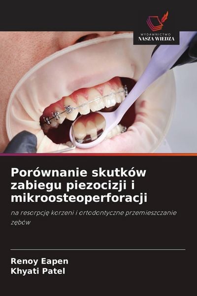Produktbild: Por&oacute;wnanie skutk&oacute;w zabiegu piezocizji i mikroosteoperforacji