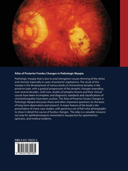 Produktbild: Atlas of Posterior Fundus Changes in Pathologic Myopia