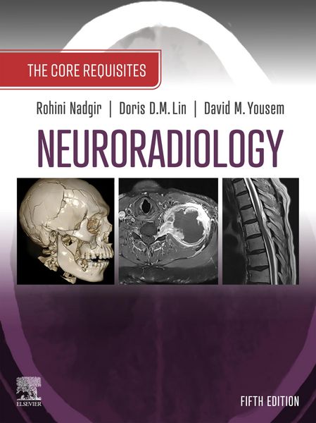 Produktbild: Neuroradiology: The Requisites E-Book