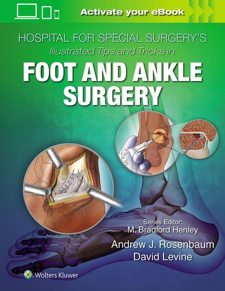 Produktbild: Hospital for Special Surgery's Illustrated Tips and Tricks in Foot and Ankle Surgery