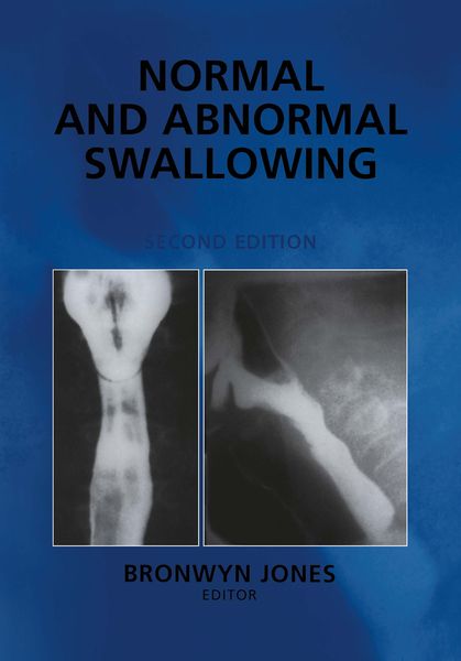 Produktbild: Normal and Abnormal Swallowing