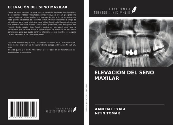 Produktbild: Elevaci&oacute;n Del Seno Maxilar