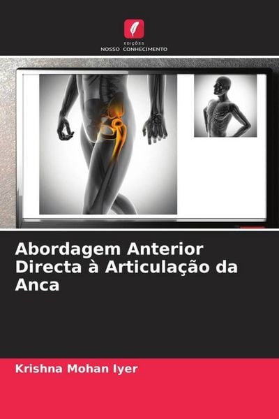 Produktbild: Abordagem Anterior Directa &agrave; Articula&ccedil;&atilde;o da Anca