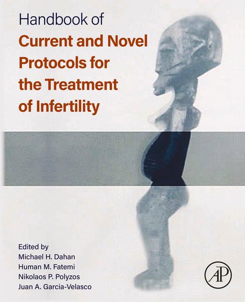 Produktbild: Handbook of Current and Novel Protocols for the Treatment of Infertility