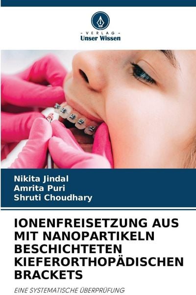 Produktbild: IONENFREISETZUNG AUS MIT NANOPARTIKELN BESCHICHTETEN KIEFERORTHOP&Auml;DISCHEN BRACKETS