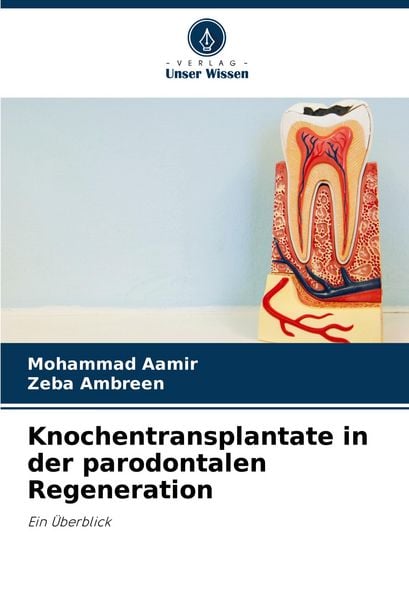 Knochentransplantate in der parodontalen Regeneration, Taschenbuch von Mohammad Aamir , Zeba Ambreen, Verlag Unser Wissen, 9786208634650