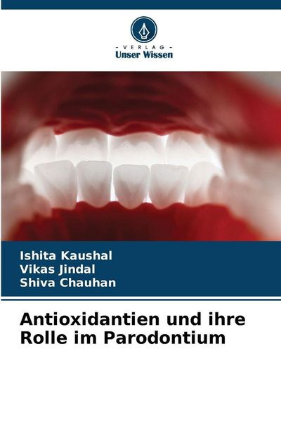 Antioxidantien und ihre Rolle im Parodontium, Taschenbuch von Ishita Kaushal , Vikas Jindal , Shiva Chauhan, Verlag Unser Wissen, 9786209288517