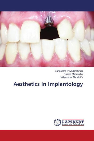 Produktbild: Aesthetics In Implantology