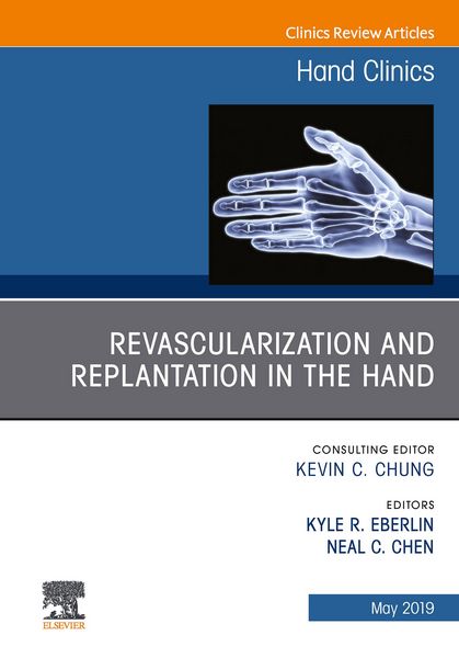 Produktbild: Revascularization and Replantation in the Hand, An Issue of Hand Clinics