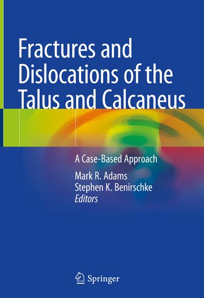 Produktbild: Fractures and Dislocations of the Talus and Calcaneus