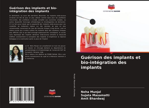 Produktbild: Gu&eacute;rison des implants et bio-int&eacute;gration des implants