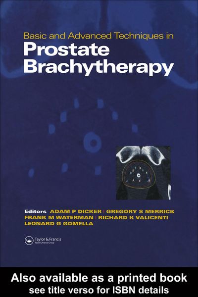 Produktbild: Basic and Advanced Techniques in Prostate Brachytherapy