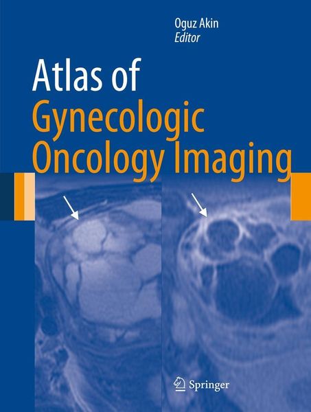 Produktbild: Atlas of Gynecologic Oncology Imaging
