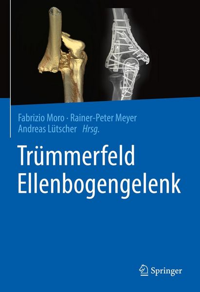 Produktbild: Tr&uuml;mmerfeld Ellenbogengelenk
