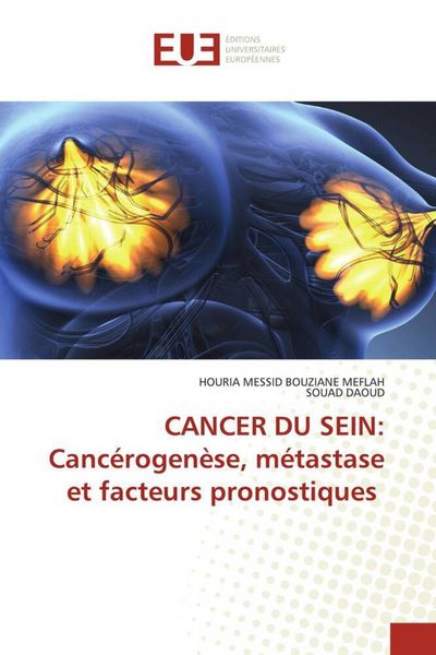 Produktbild: CANCER DU SEIN: Canc&eacute;rogen&egrave;se, m&eacute;tastase et facteurs pronostiques