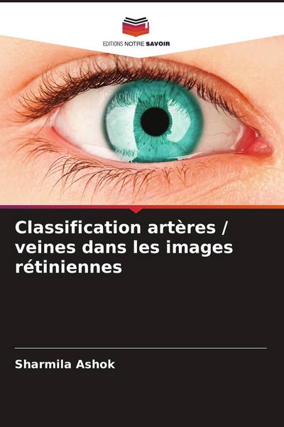 Produktbild: Classification art&egrave;res / veines dans les images r&eacute;tiniennes