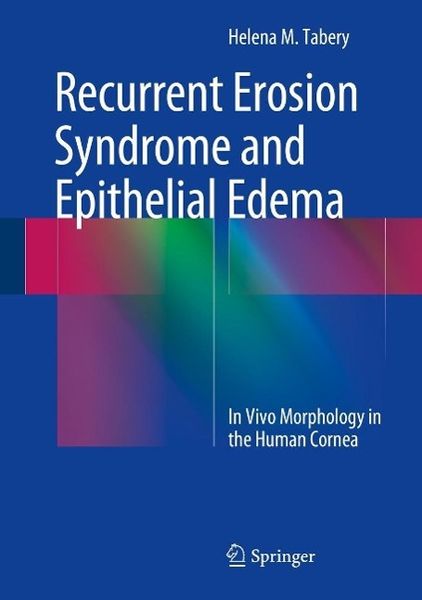 Produktbild: Recurrent Erosion Syndrome and Epithelial Edema