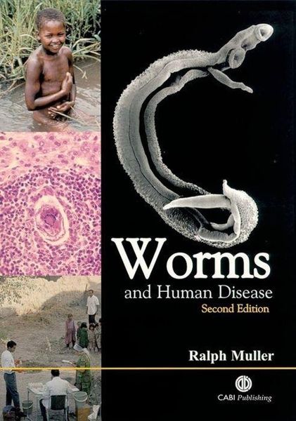 Produktbild: Worms and Human Disease