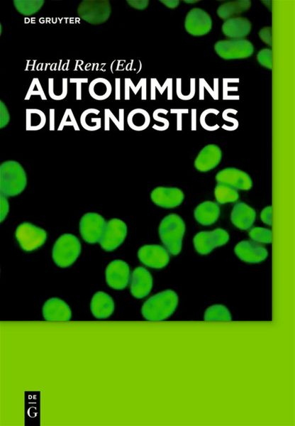 Produktbild: Autoimmune Diagnostics
